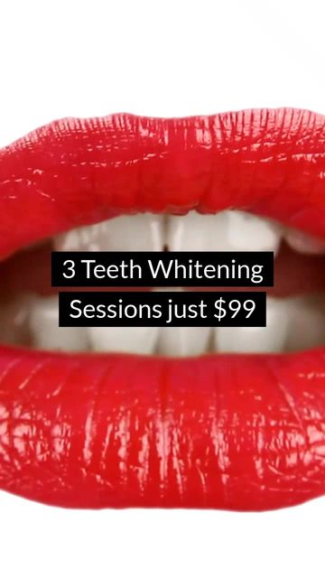Teeth Whitening Video Template